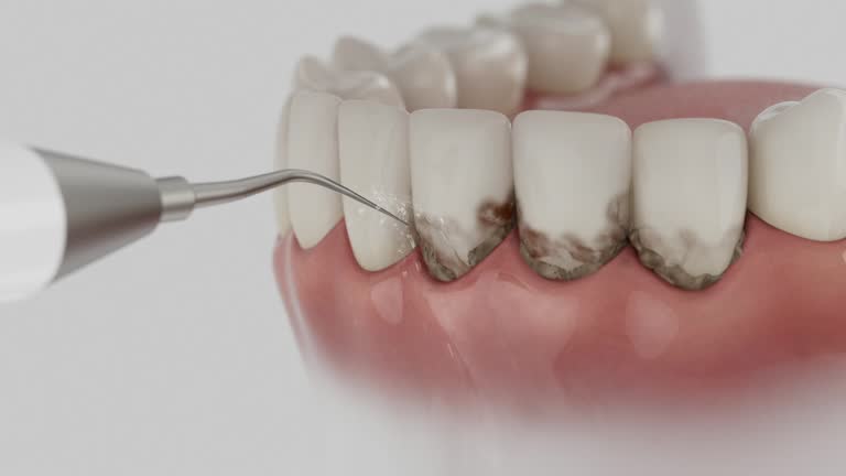 Trusted Invisalign Clear Aligners service in Tulsa, OK - Dentist Open Now